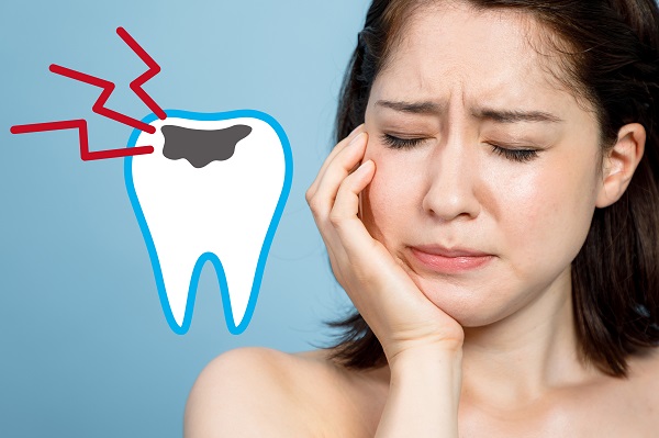 上顎前突による虫歯リスク