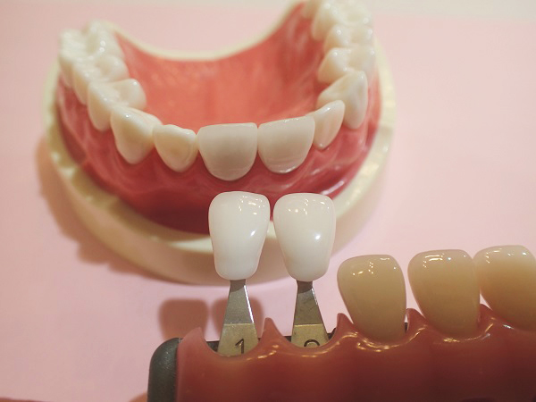 前歯2本の口ゴボ治療